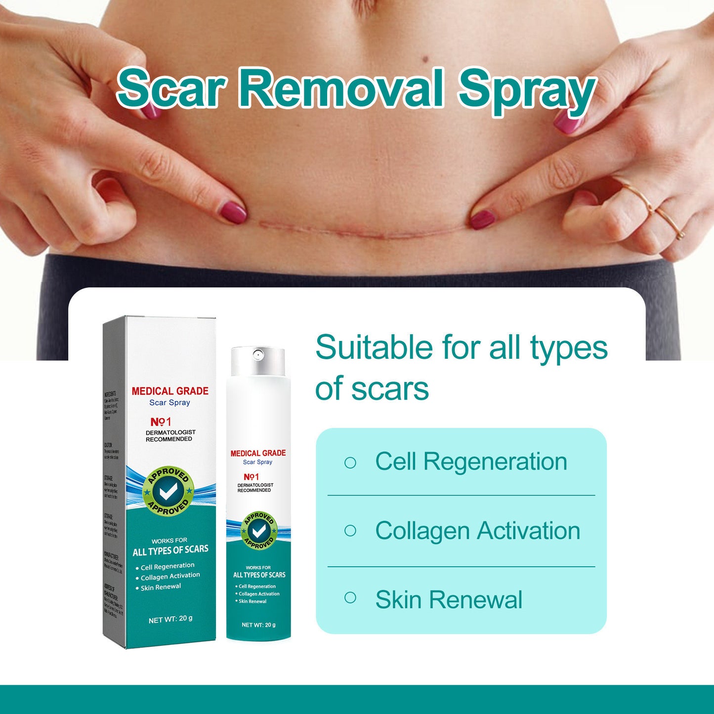 Surgical Scar Spray - Medical Grade